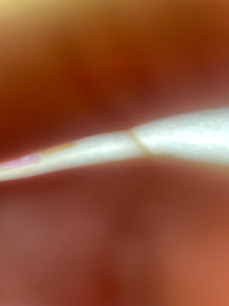 Chip